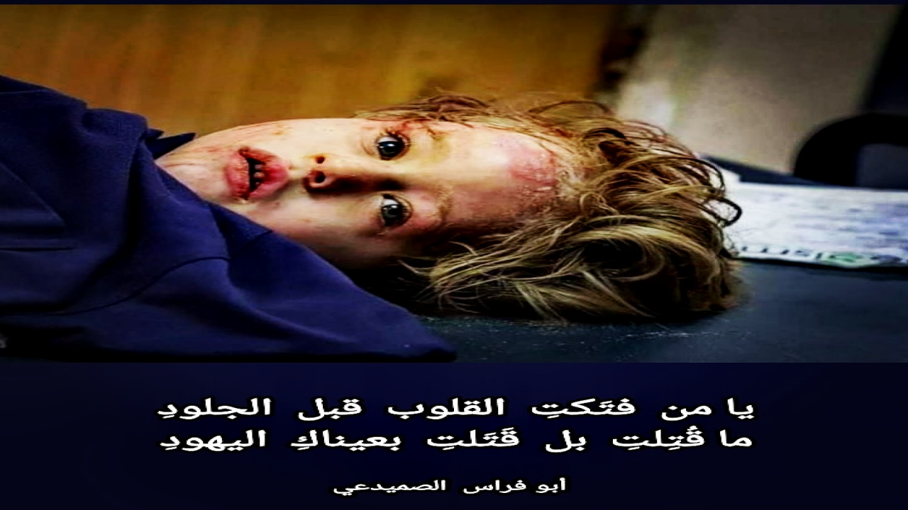 يا صغيرتي الجميلةيا من فتكتِ القلوب قبل الجلودِما قُتِلتِ بل قَتلتِ بعيناكِ اليهودِ